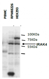 DDX0340A488-50 - IRAK4