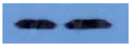 DM1036 - Kallikrein-3 / PSA / KLK3