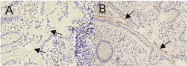 DM1201 - CD66a / CEACAM1