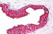 DM182P - Cytokeratin 5