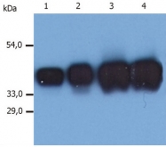 DM274PX - Cytokeratin 19