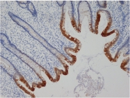 DM274PX - Cytokeratin 19