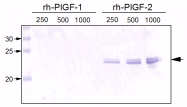 DM3524 - Placenta growth factor / PGF