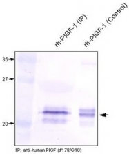 DM3525 - Placenta growth factor / PGF