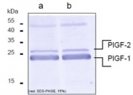 DM3525 - Placenta growth factor / PGF