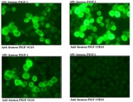 DM3525 - Placenta growth factor / PGF