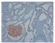 DM3614P - Podoplanin