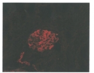 DM3614P - Podoplanin