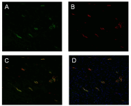 DM3614P - Podoplanin