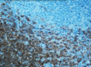DM422 - CD3