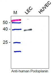 DP3512 - Podoplanin
