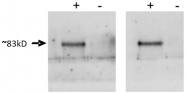 DP3516 - PROX-1