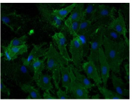 DP3517P - CD105 / Endoglin