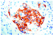 DRM018 - Synaptophysin / SYP
