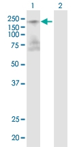 H00000002-D01 - Alpha-2-macroglobulin / A2M