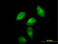 H00000012-B01P - Alpha-1-antichymotrypsin / ACT
