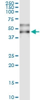 H00000012-D01 - Alpha-1-antichymotrypsin / ACT