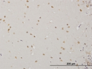 H00000027-M09 - ABL2
