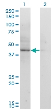 H00000039-M01 - ACAT2 / ACTL