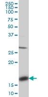 H00000052-M01 - ACP1 / LMW-PTPase