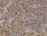 H00000053-M01 - ACP2 / LAP