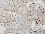 H00000059-M01 - ACTA2 / aortic smooth muscle Actin