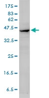 H00000059-M02 - ACTA2 / aortic smooth muscle Actin