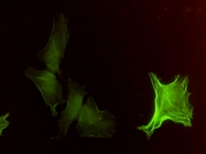 H00000059-M02 - ACTA2 / aortic smooth muscle Actin