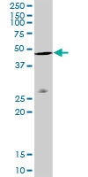 H00000060-D01P - Actin beta / ACTB