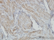 H00000060-M01 - Actin beta / ACTB