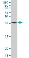 H00000060-M03 - Actin beta / ACTB