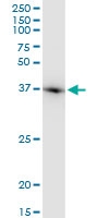 H00000060-M03 - Actin beta / ACTB