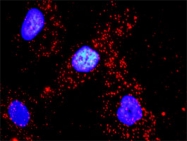 H00000071-M01 - Actin gamma / ACTG