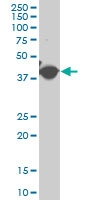H00000072-A01 - gamma 2 smooth muscle Actin / ACTG2