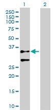 H00000072-D01P - gamma 2 smooth muscle Actin / ACTG2