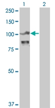 H00000081-M01 - Alpha-actinin-4 / ACTN4