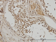 H00000081-M01 - Alpha-actinin-4 / ACTN4