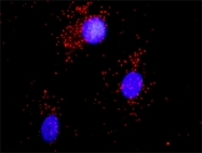 H00000087-D01P - Alpha-actinin-1 / ACTN1