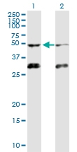 H00000091-D01 - Activin receptor type 1B / ACVR1B