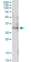 H00000093-D01 - Activin receptor type 2B / ACVR2B