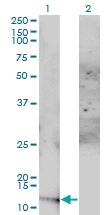 H00000097-M01 - Acylphosphatase 1 / ACYP1