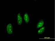 H00000104-B01P - ADARB1 / ADAR2