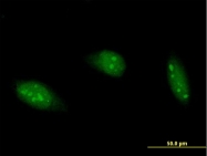 H00000104-B02P - ADARB1 / ADAR2