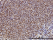 H00000118-M01 - Alpha-Adducin / ADD1