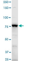 H00000120-A01 - Gamma-adducin (ADD3)