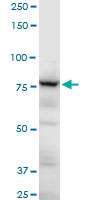 H00000120-A01 - Gamma-adducin (ADD3)