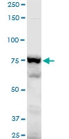 H00000120-A01 - Gamma-adducin (ADD3)