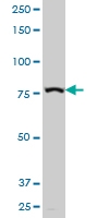 H00000120-A01 - Gamma-adducin (ADD3)
