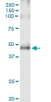 H00000154-D01 - Beta-2 adrenergic receptor