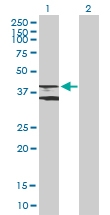 H00000155-B01P - Beta-3 adrenergic receptor